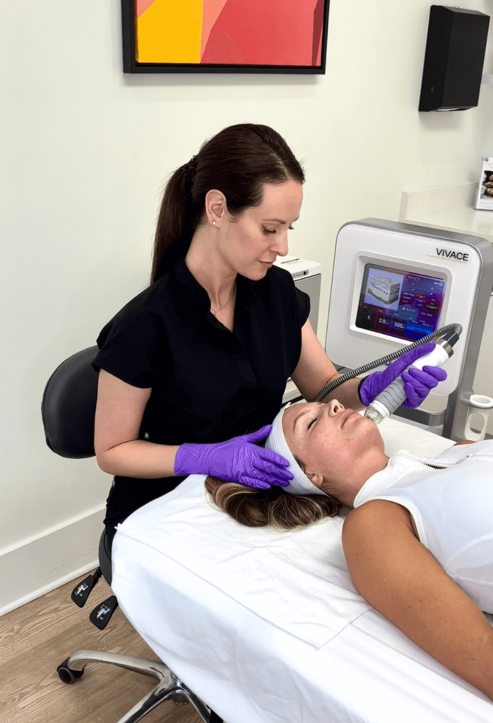 What is Vivace RF Microneedling? 1 Vivace 1