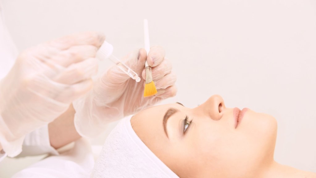 What Are Chemical Peels? What Should I Expect After Treatment? 3 What Are Chemical Peels? What Should I Expect After Treatment?