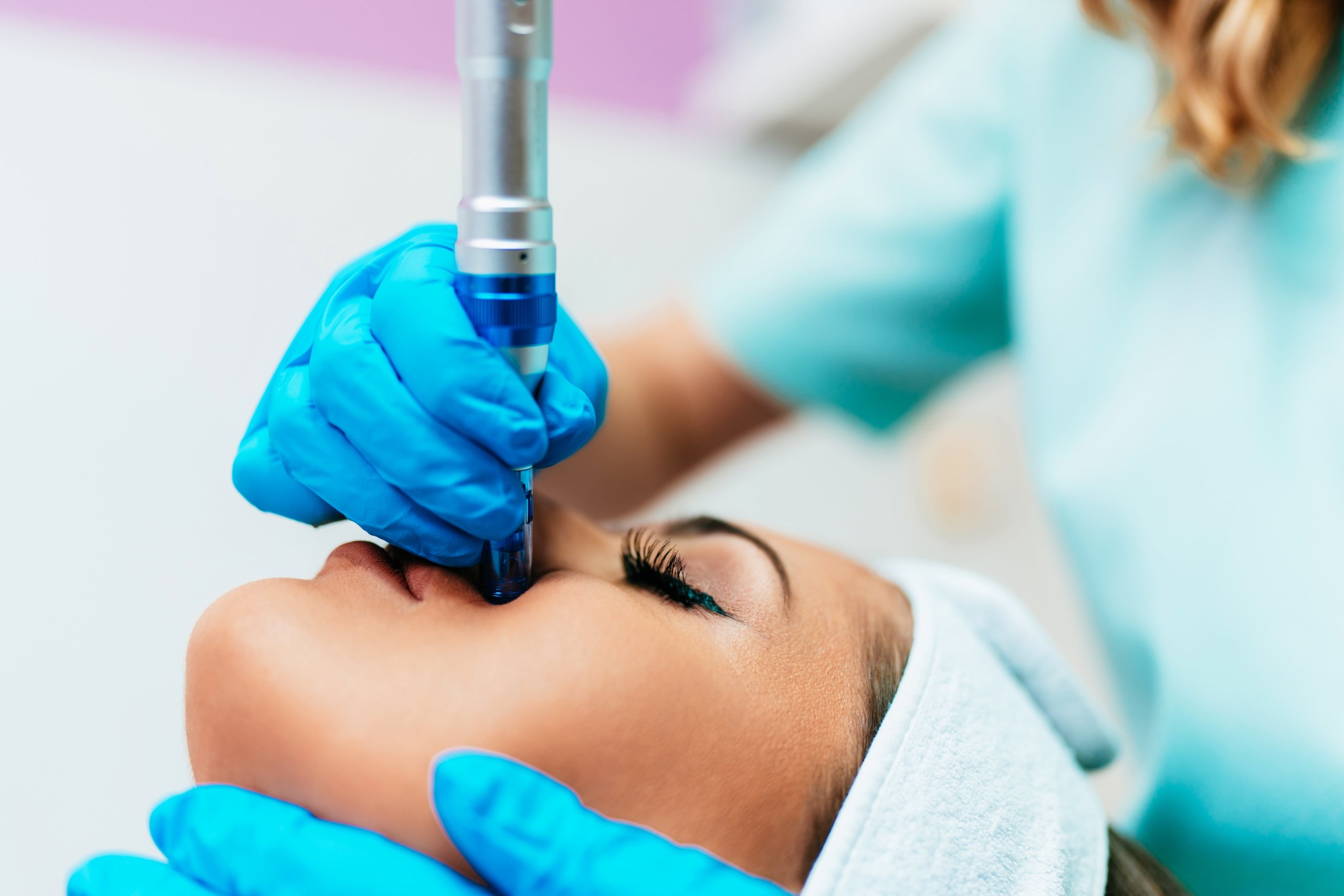 MOXI™ Treatment Unleashing the Power of Skin Rejuvenation