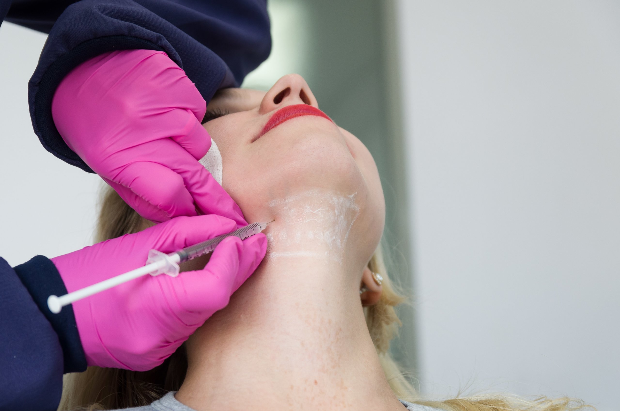 Kybella by Modern Looks Med Spa in Alpharetta GA