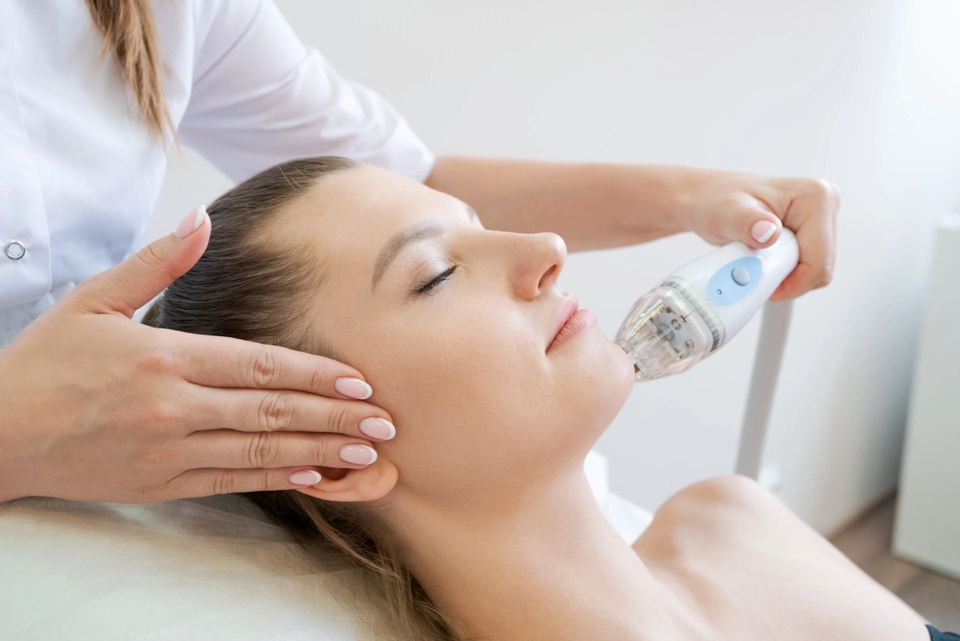 Blog 1 What is Vivace RF Microneedling